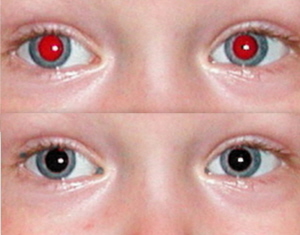 red eyes