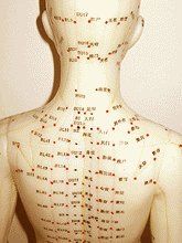 acupuncture